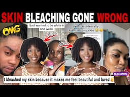 MERCY!😱 SKIN BLEACHING GONE WRONG! THE RISK BEHIND THE SKIN LIGHTENING CRAZE + COLORISM | TIKTOK