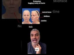 FACELIFT TRANSFORMATION! Plastic Surgeon's Pre-Facelift Analysis