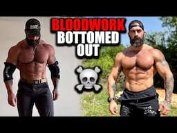 OFF TRT Bloodwork – My Testosterone Is Basically ZERO