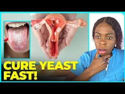 The boric acid:The yeast infection solution