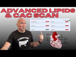 Four-Year Carnivore Bloodwork & CAC Scan Reviewed by Heart Surgeon