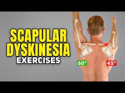 3 Scapular Dyskinesis Exercises