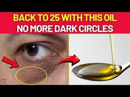 How I Get Rid of Dark Circles and Puffy Under Eyes NATURALLY With Castor Oil | Better Vision