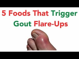 5 Foods That Trigger Gout Flare-Ups (Backed by Science!)