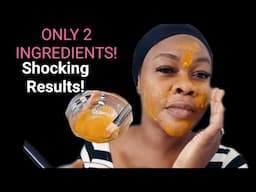 From Dull to Radiant Skin - My 2- Ingredient Skin Miracle