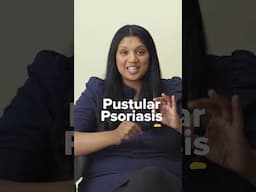 4 Types of Psoriasis You NEED to Know About!