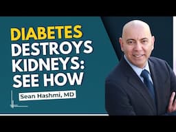 3 Ways Diabetes Damages Kidney Function: A Nephrologist Explains