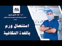 استئصال ورم بالغدة النكافية