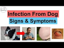 Echinococcosis (Disease From Dogs) Signs & Symptoms (Liver, Lung and Brain Cysts)