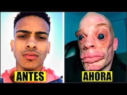 15 Personas Que Se ARREPINTIERON Muy TARDE De Sus Cirugias Plasticas