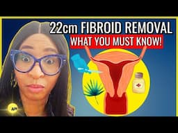 Can a 22 cm Fibroid Be Removed Without Surgery? A Critical Guide.