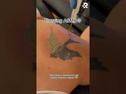 ASMR: Tattoo removal ❄️ #removery #tattooremoval