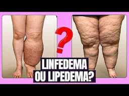 Lipedema x Linfedema: como identificar e tratar?