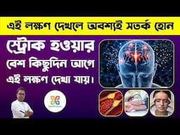 ব্রেইন স্ট্রোক হওয়ার বেশ কিছুদিন আগের থেকেই দেখা যায় এই লক্ষণ গুলি। 6  symptoms of brain stroke.