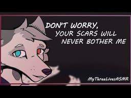 Jashiha notices your scars [POV ASMR]