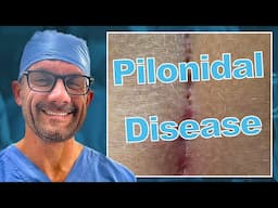 Why is Pilonidal Disease is So Frustrating?