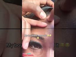 1 Minute Of Top ASMR Pimple Popping Video №106