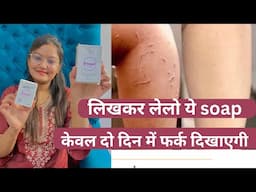 I tried Epifager  kojic acid SOAP | 2 day’s see results