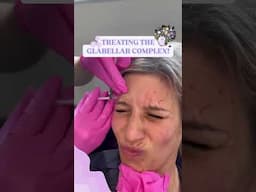 Treating the Glabellar Complex