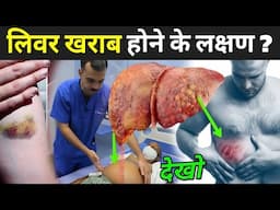 लिवर खराब होने के लक्षण ? | Liver Damage Ke Lakshan | Symptoms Of Liver Problems