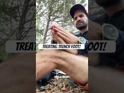 Trench foot update: they’re recovering ☺️