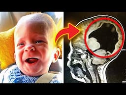 Boy Born Without A Brain, 6 Years Later Look At What Doctors Find Inside