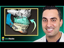 How Do You Plan the Perfect Jaw Surgery?