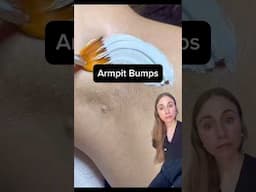 Why People Are Getting Facials On Their Armpits #dermreacts