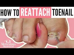 Toenail Repair & Athletes' Feet Recover: Learn to Fix Years of Damage Pedicure Tutorial
