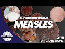 Measles