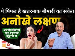 पिंपल्स से पता चलेगी आपकी बीमारी | What Your Pimples Say About Your Health | Digestion System
