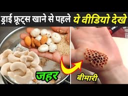 ड्राई फ्रूट्स खाने से पहले ये वीडियो देखे | Dry Fruits Side Effects | Dry Fruits Ke Nuksan