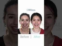 Akane's transformation