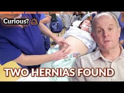 Hernia Repair with Surgical Mesh | Inside The Operating Theatre