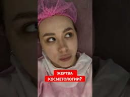 Как вы относитесь к таким процедурам? #хоффман #косметология #уколыкрасоты