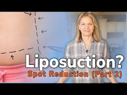 I Met With A Liposuction Doctor. Here’s What I Learned [Spot Reduction - Part 2]
