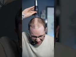 I Deleted My Hair…