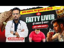 अगर थकान, पेट फूलना हो रहा है। तो Fatty Liver हो सकता है क्या? ज़रूर जानिए कारण। | Rungta Hospital