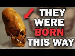 DNA Samples of Elongated Skulls Prove It's a LOST RACE! (DNA, Cranium Analysis)