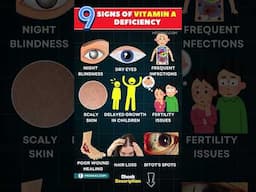 Vitamin A Deficiency: These Symptoms Are Often Missed!