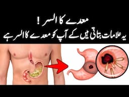 Stomach Ulcer Treatment In Urdu Hindi - Dr Irfan Azeem