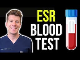 Doctor explains Erythrocyte Sedimentation Rate (ESR) blood test
