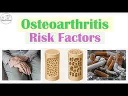 Risk Factors of Osteoarthritis (Occupations, Dietary Factors and More)