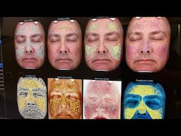 Find out what's wrong with your face and new men's spa