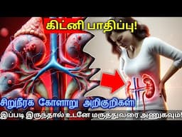 கிட்னி பாதிப்பு அடையாளங்கள் – உங்கள் உடலில் இது இருந்தா உடனே டாக்டரை பாருங்க! 🚨 | STAR LABORATORY
