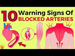 10 Warning Signs of Blocked Heart Arteries in Legs and Feet | VisitJoy