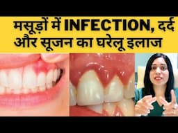 मसूड़ों में Infection, दर्द और सूजन का घरेलू इलाज || Masudon Ki Problem Ka Gharelu Ilaj ||