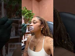 GETTING MY LIP FILLERS DISSOLVED