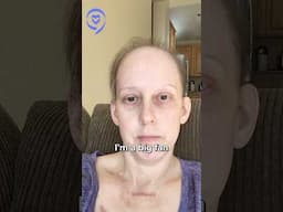 I Will Never Be The Same After My Stage 4 Cancer Diagnosis