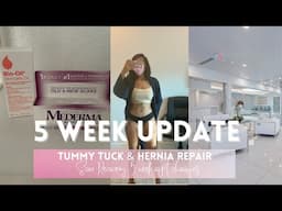 5 week tummy tuck update | Vlog